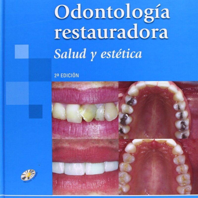 Odontología Restauradora Salud y estética - Nocci Conceicao- 2a Ed.